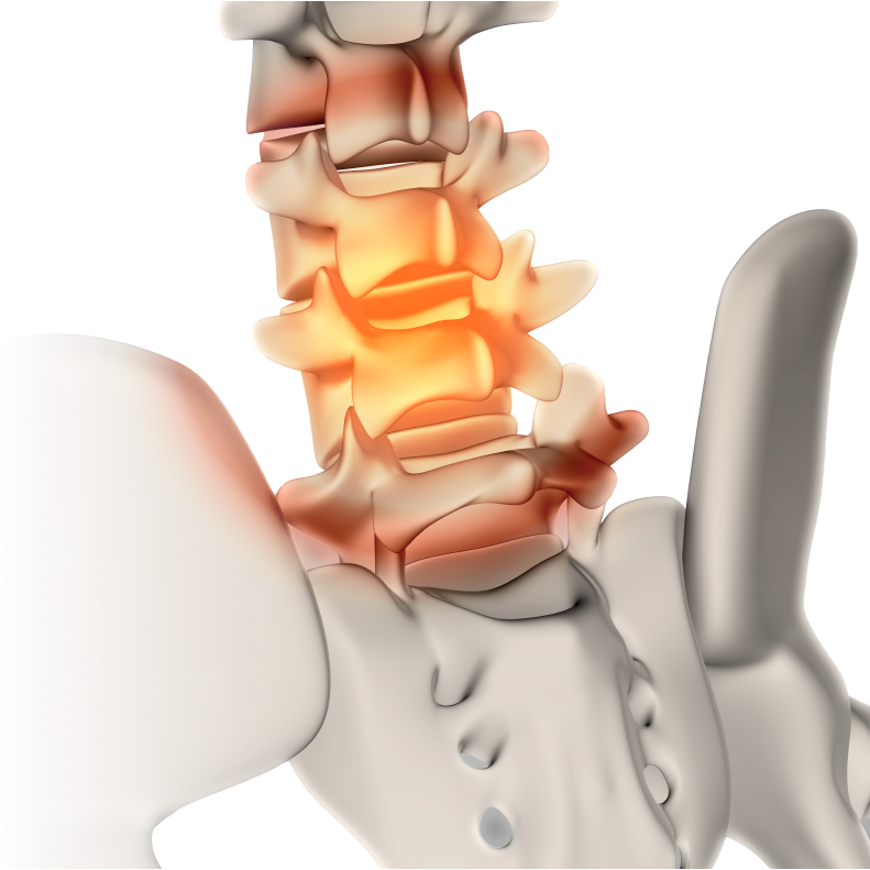 스파인패스 히어로